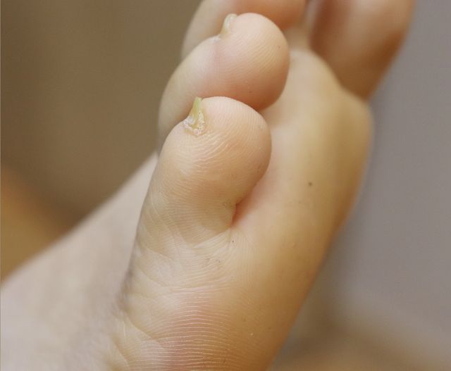 35세 여성 · 7개월 경과