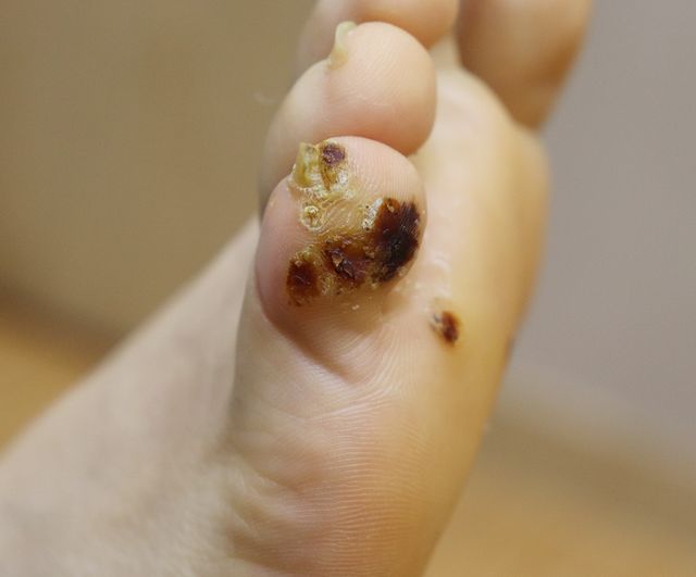 35세 여성 · 7개월 경과 · 치료 전
